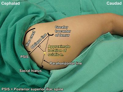 针灸基本功系列第3篇,针灸基础知识五腧穴的背诵方法