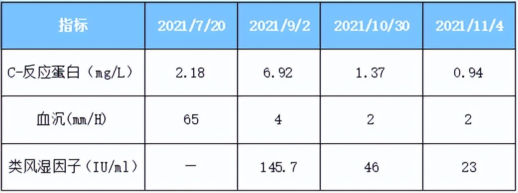 阿达木单抗能治疗类风湿关节炎吗,阿达木单抗治疗类风湿关节炎优势