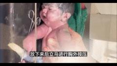 婴儿发生心跳呼吸骤停时,婴儿刚出生心脏就出现骤停