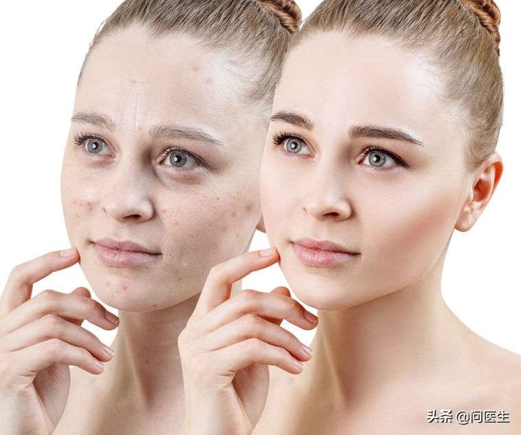 反反复复的长痘痘是什么原因,长痘痘老是反反复复怎么回事