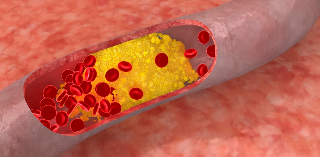 常年胸痛胸闷一般考虑是什么原因,老是胸闷胸痛看什么科