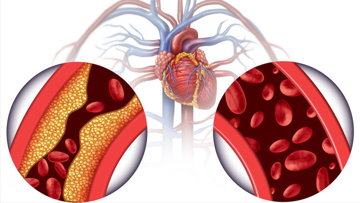 50岁以后补充叶酸有哪些作用,50岁后补叶酸有什么好处