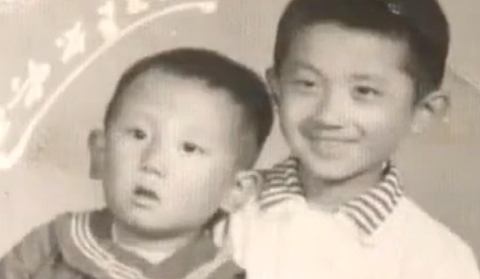 男孩得了怪病头部巨大,男孩得了怪病只有半个头