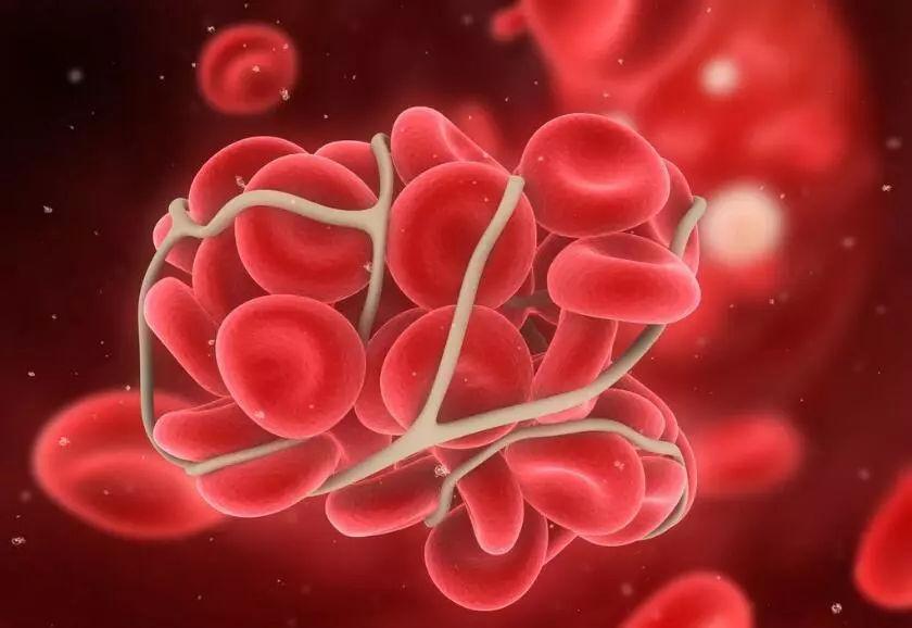 李开复抗癌成功过程,李开复抗癌从癌症到肿瘤消失9年