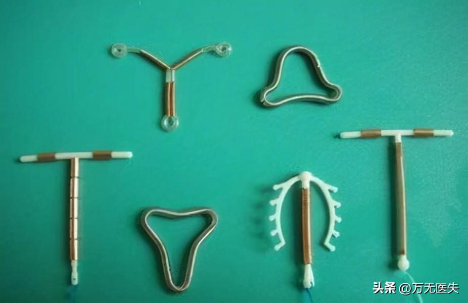 女性上环详细流程,女人上环全步骤