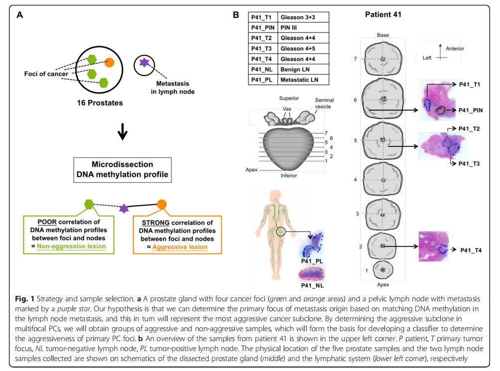 dna甲基化防癌检测的卖点,dna甲基化利器