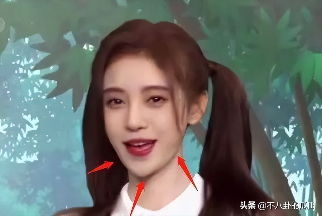 蔡徐坤下巴太尖惹争议图片,蔡徐坤下巴是假体吗