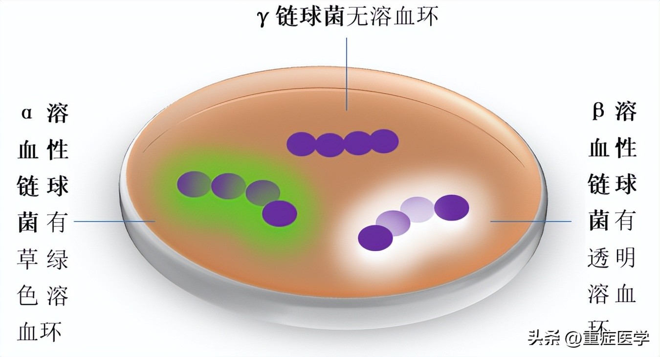 链球菌感染很常见，你至少需要知道这四点！