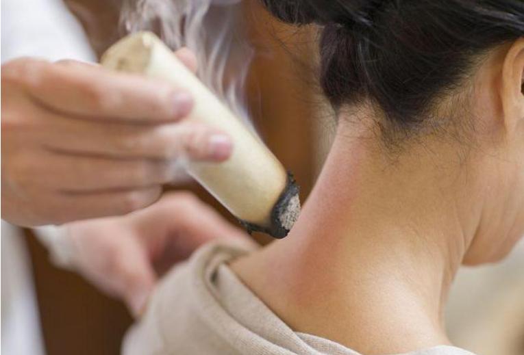 灸绳和马氏温灸法哪个更好,马氏温灸如何灸风池