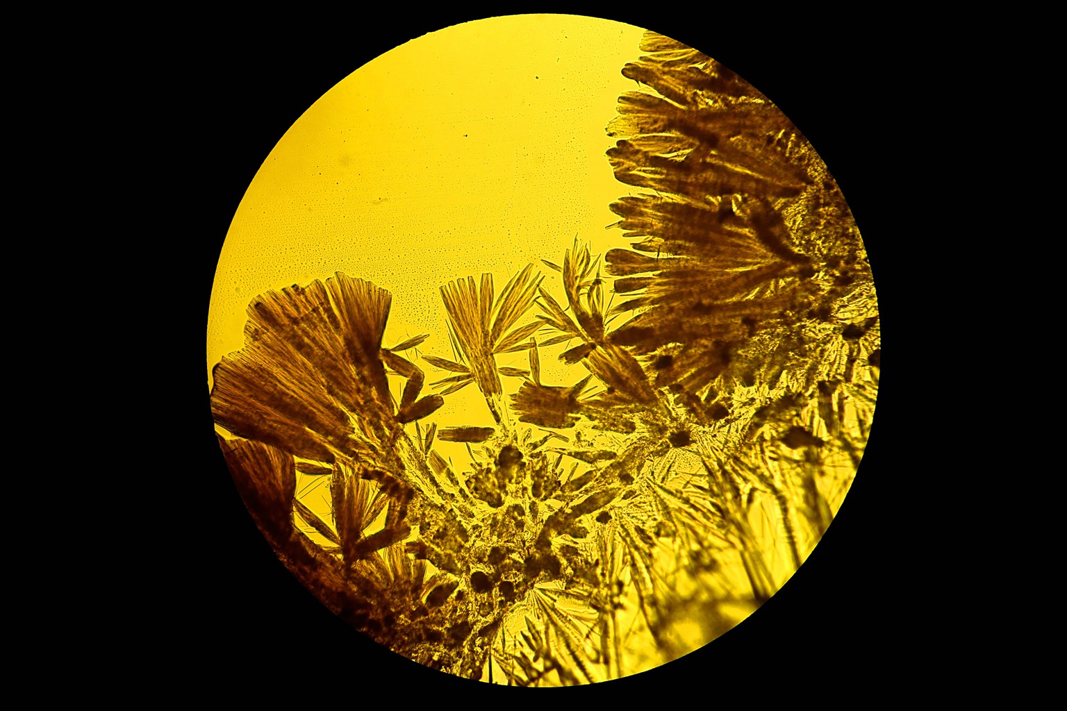 显微镜下结晶图片,显微镜下针状结晶图