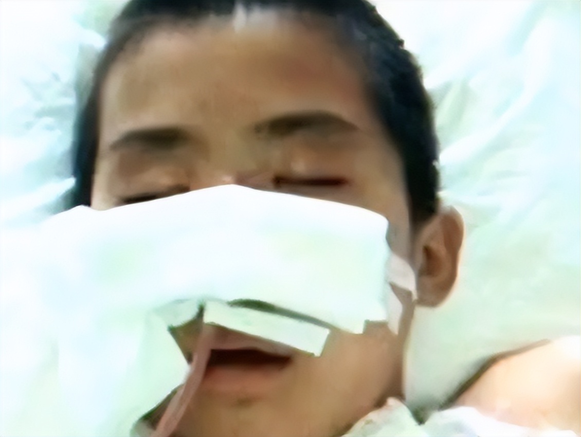 十三岁男孩被灌入高压气后续,男子被高压枪充气后续