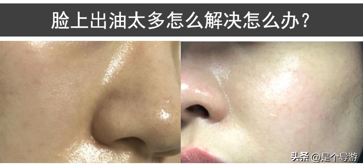 脸部爱出油头发也很油是什么原因,脸上总是出油怎么办小妙招