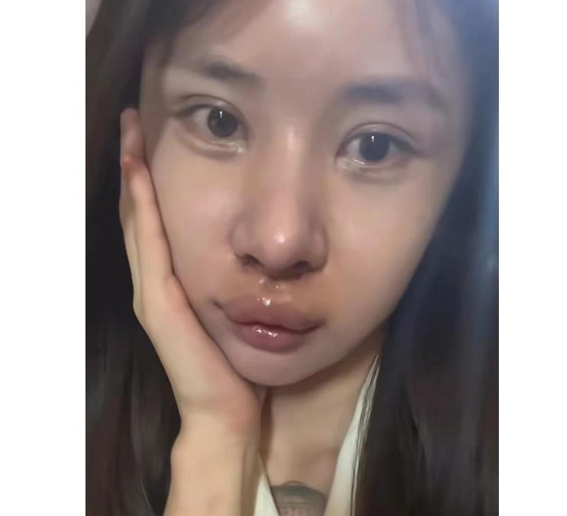 去泰国做变性手术的网红是谁,28岁网红去泰国做变性