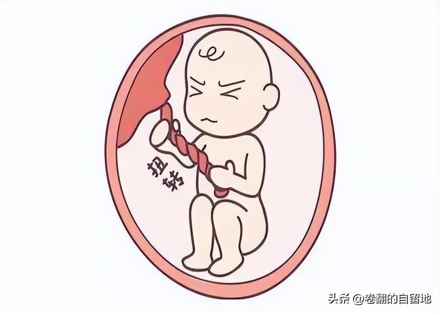 孕晚期宝宝突然不动也没有宫缩,孕晚期宝宝突然不怎么动怎么回事