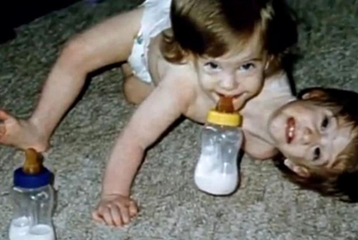 连体人娶妻生子,连体人如何生子