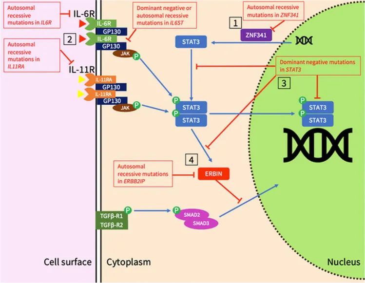 免疫缺陷病会并发什么病,什么是免疫缺陷肺部感染