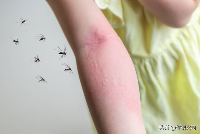 小宝宝如何避免蚊虫叮咬,狗剃毛怎么避免蚊虫叮咬