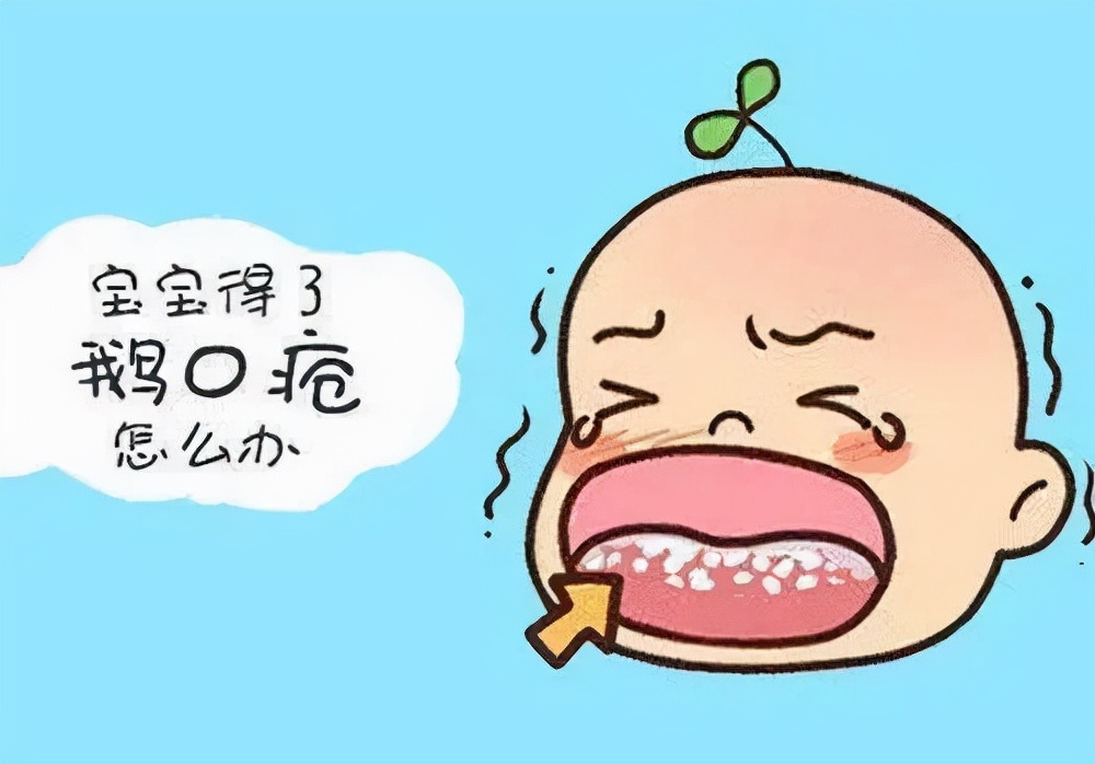 宝宝出现口腔有鹅口疮怎么治疗,宝宝出现鹅口疮怎么办