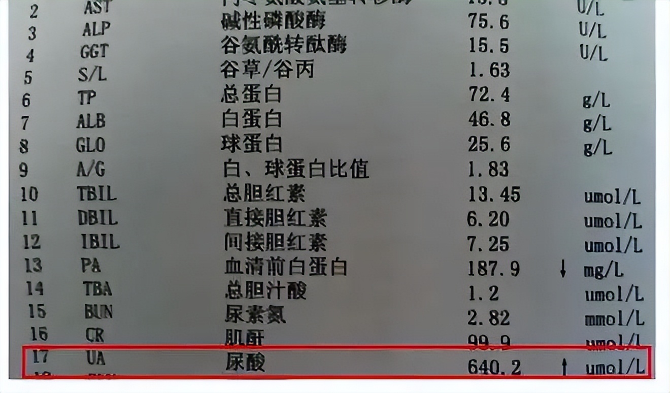 高尿酸痛风是什么原因引起的,高尿酸没症状可怕不