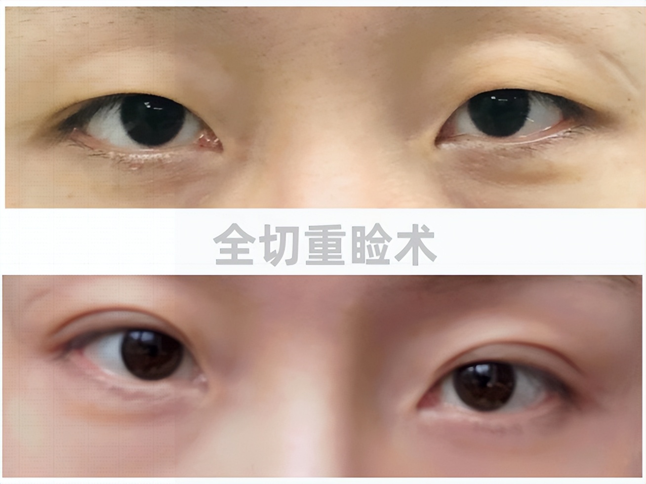 夏天美容整形,医院美容护肤项目