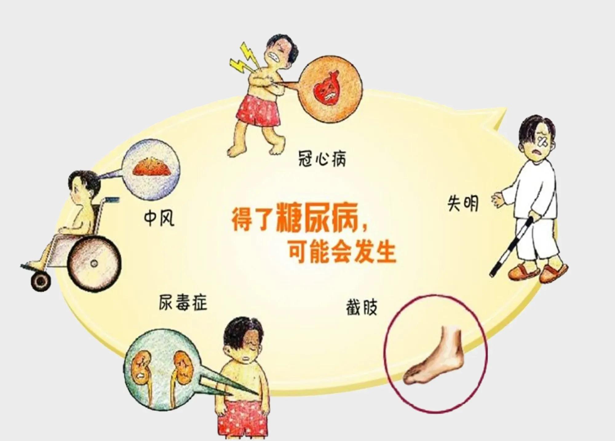 糖尿病科普哪些人容易患糖尿病,糖尿病是怎样形成怎么预防糖尿病