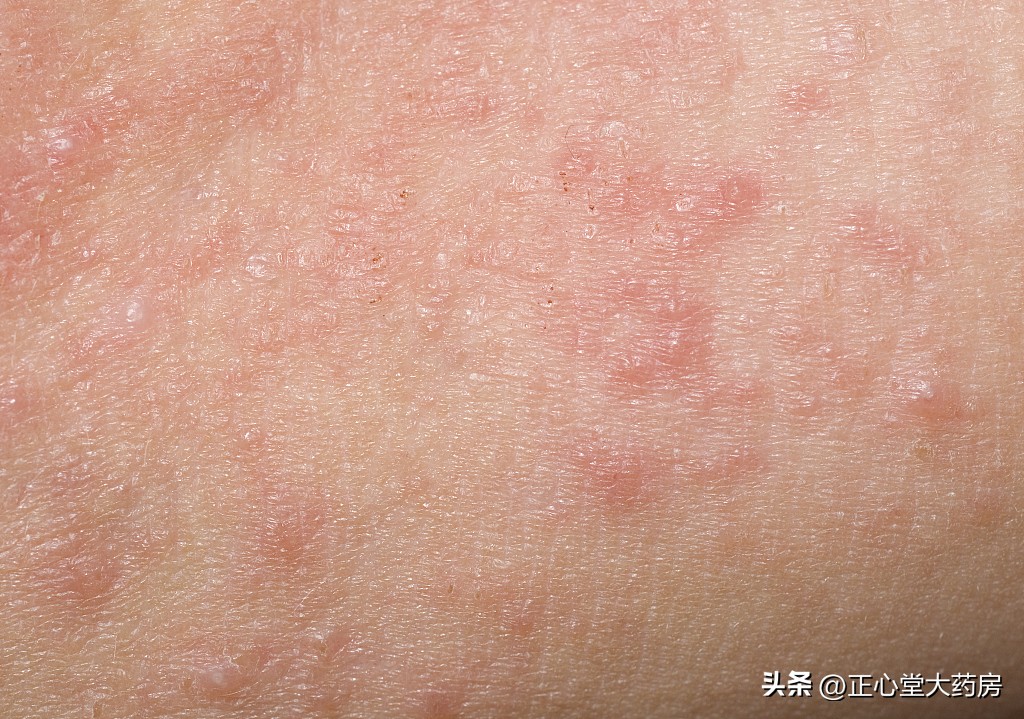 内衣和袜子一起洗危害有多大,内衣和袜子一起洗会感染脚气吗