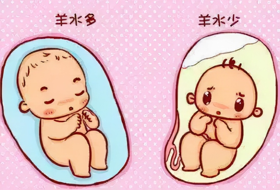 羊水为什么叫羊水它都有什么作用,孕期破水的科普