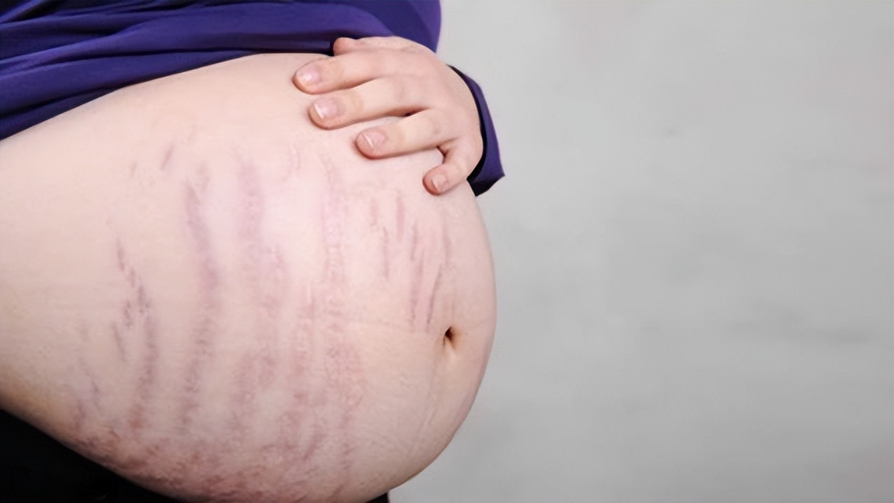 做过宫外孕剖腹产还能顺产吗,剖腹产三次了宫外孕怎么办