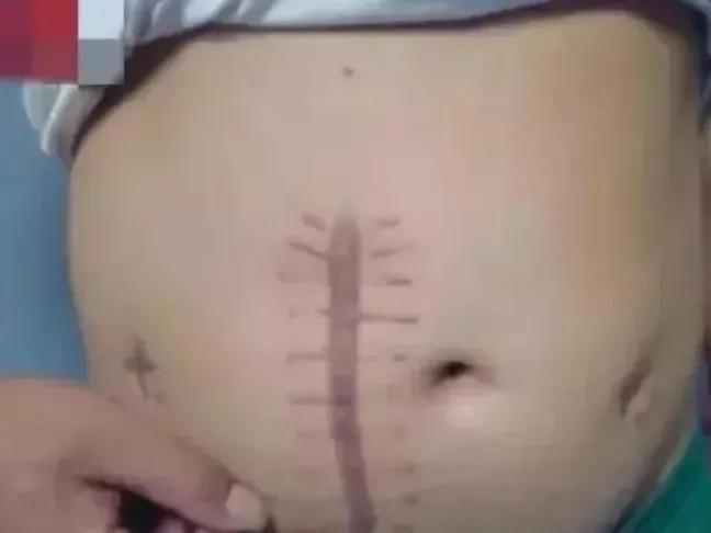 真实满清酷刑,缅北的十大酷刑