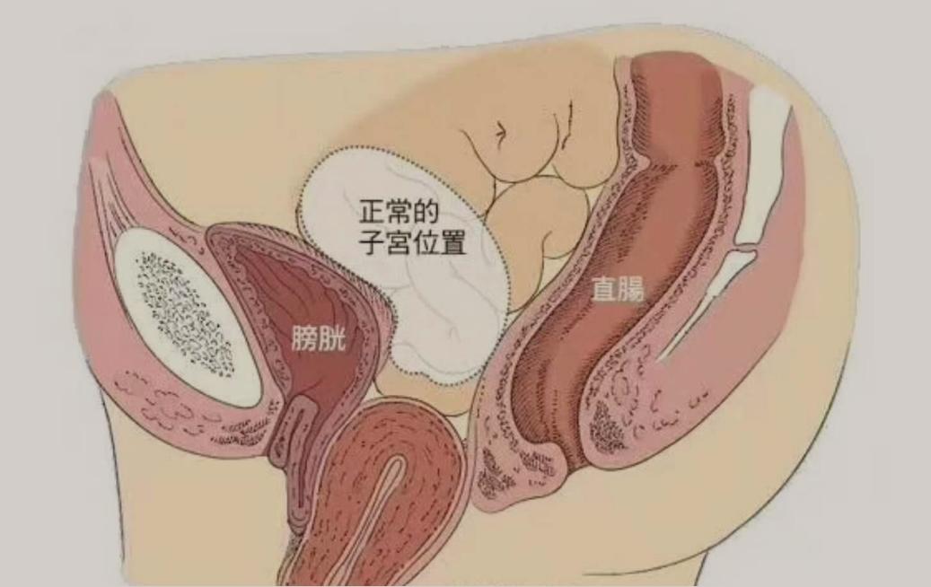 医生不告诉你妇科秘密,医院检查发现没有子宫正确吗