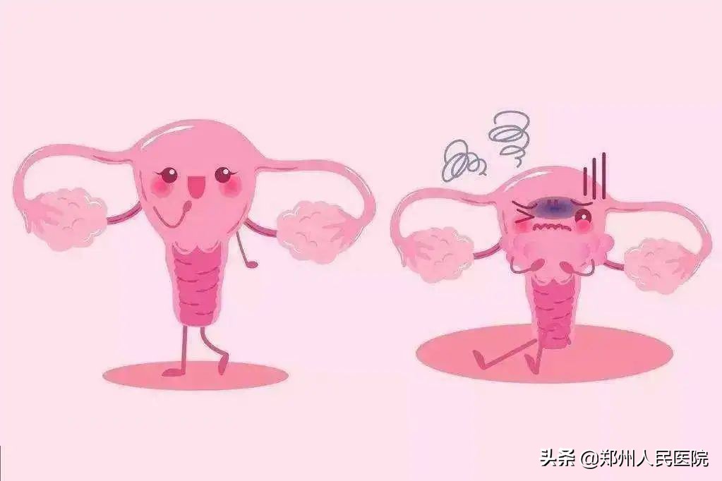 痒到痛不欲生！*处私**的这些尴尬如何解？