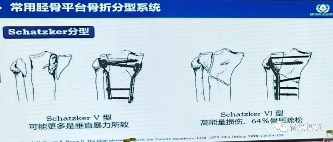 国家卫健委主办的骨创伤专项能力培训项目----下肢损伤学习班