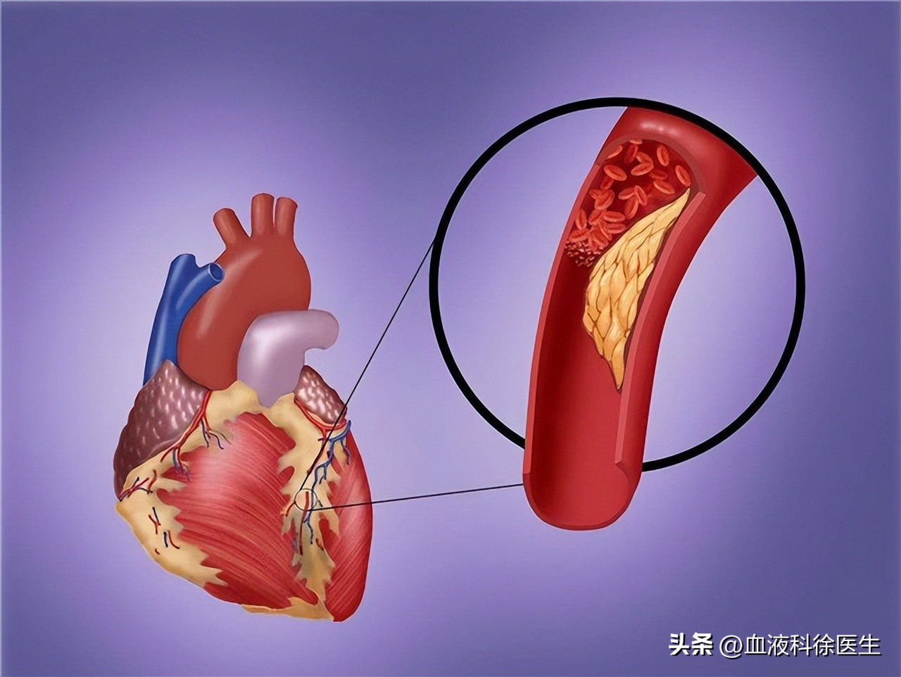 阿利沙坦酯片降压效果怎样,降压药阿利沙坦酯片的副作用