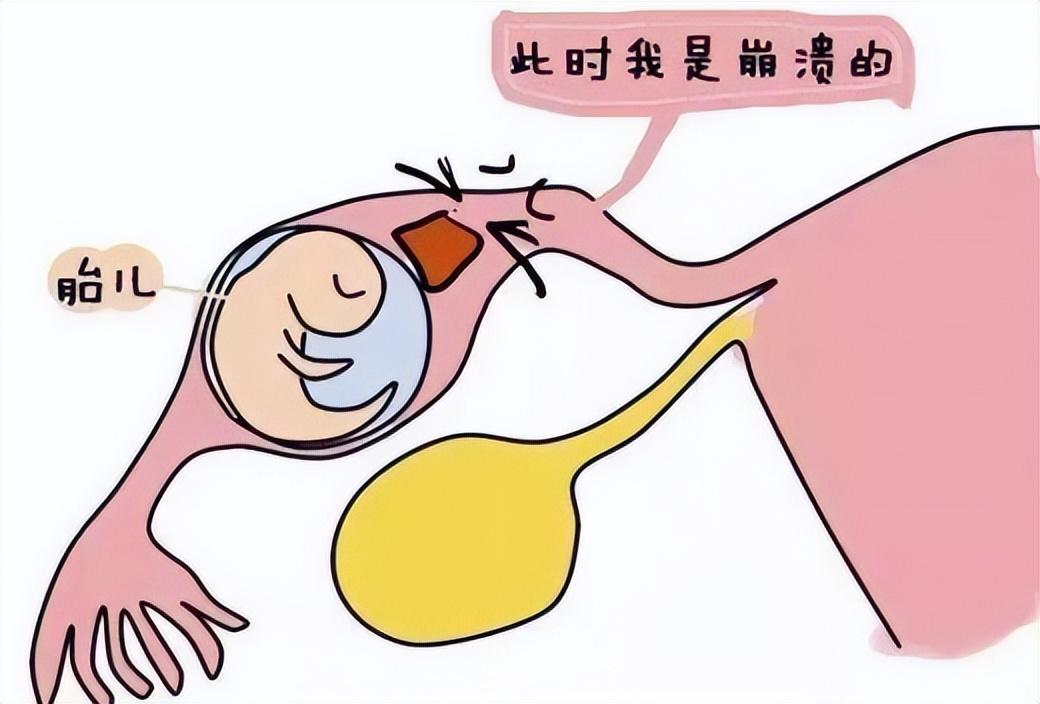 月经结束几天后有褐色分泌物腰酸,月经结束后有褐色分泌物影响排卵