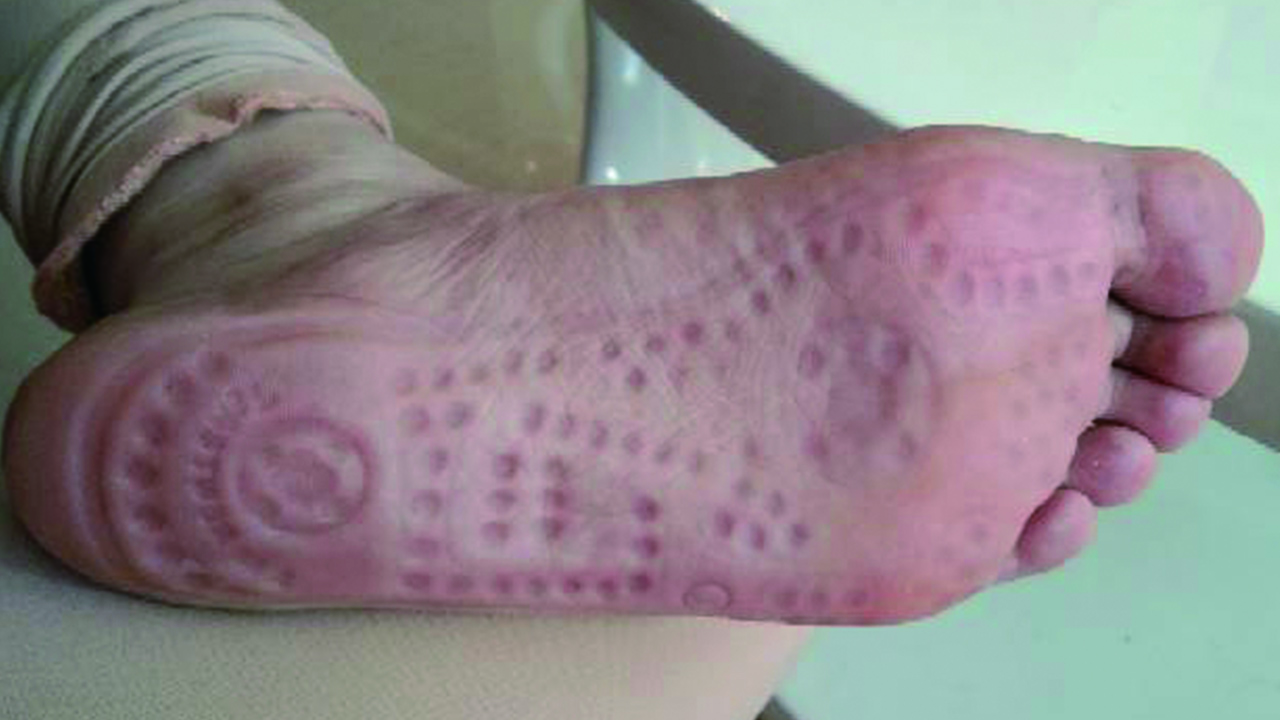 按摩鞋是不是智商税,足疗鞋是交智商税吗