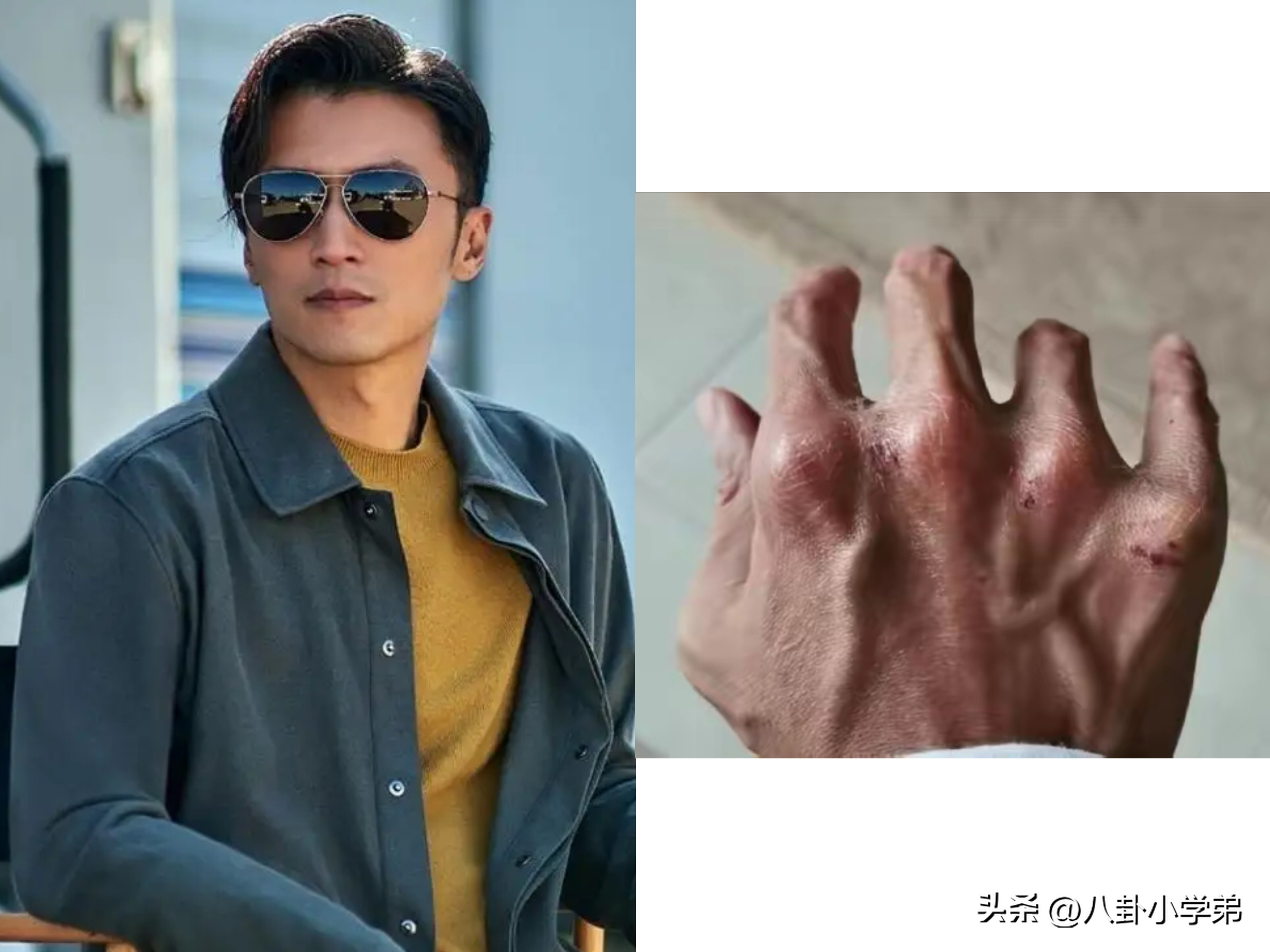 谢霆锋的手，黄晓明的脚，赵丽颖的血栓，让多少“流量明星”脸红