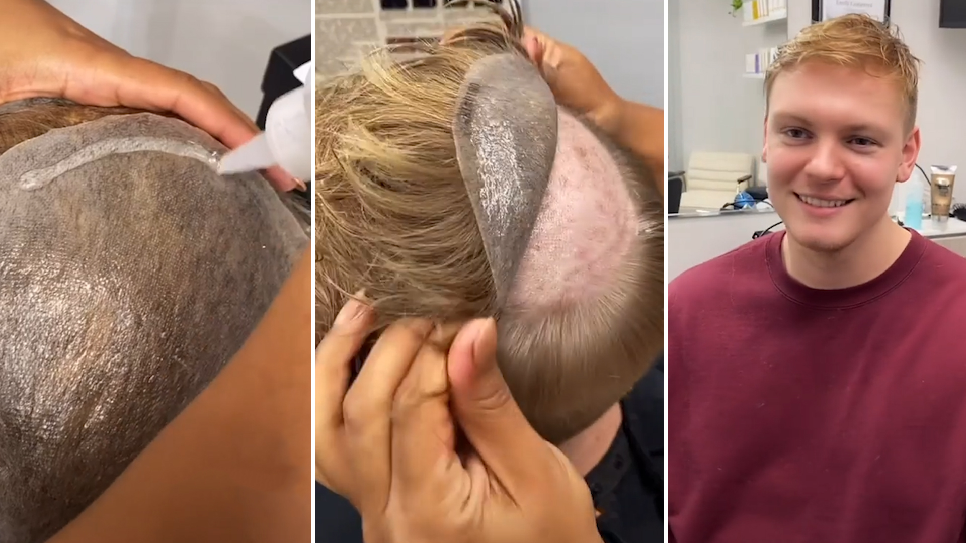 假发真实性大测评哪种假发更真实,买假发要注意的雷点