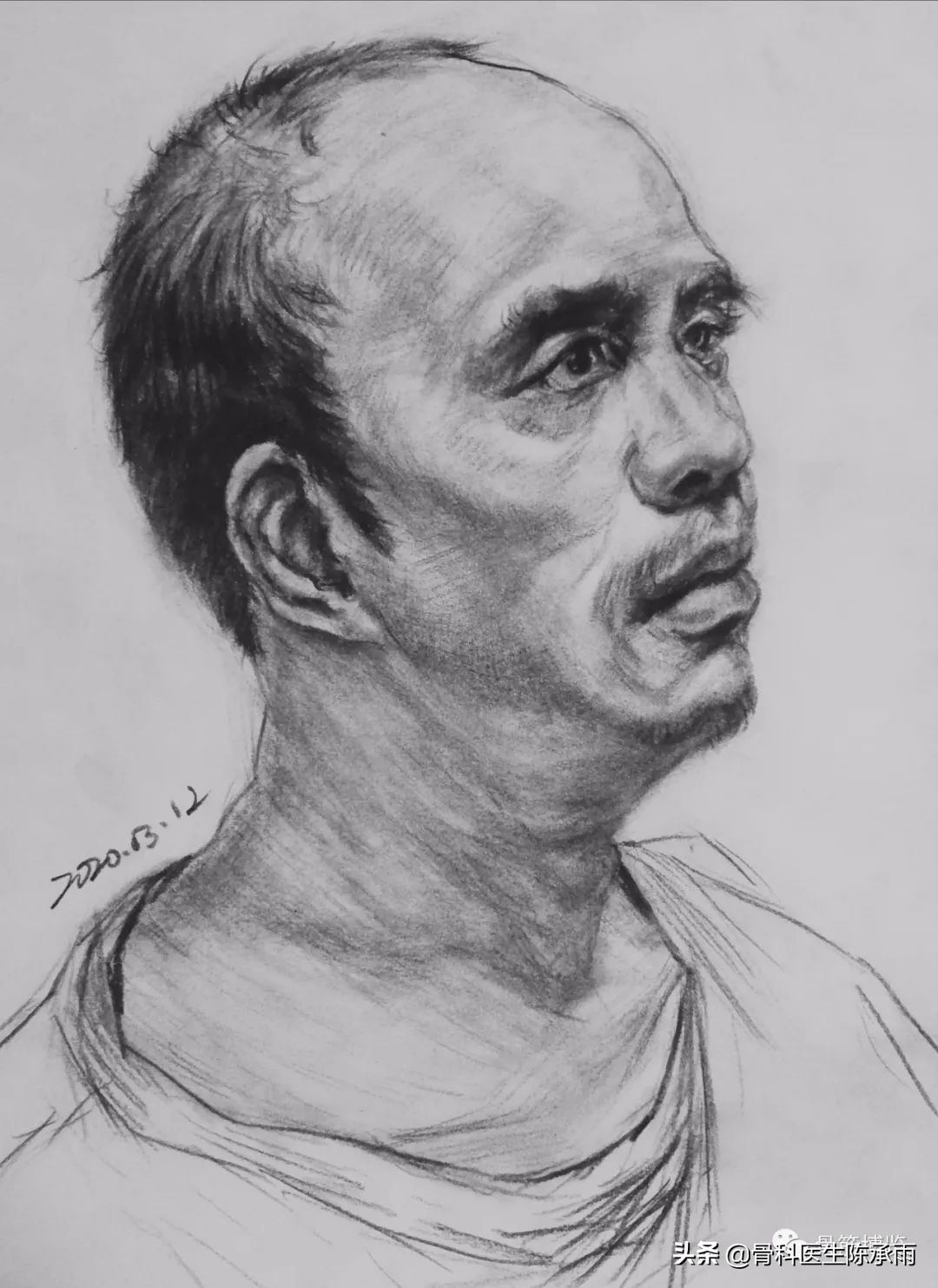 腕部切割伤康复训练,腕部割伤如何处理