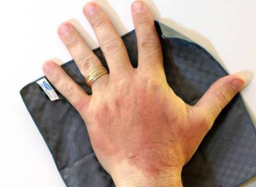 被开水烫伤怎么办最快最有效,不小心被开水烫了怎么快速处理