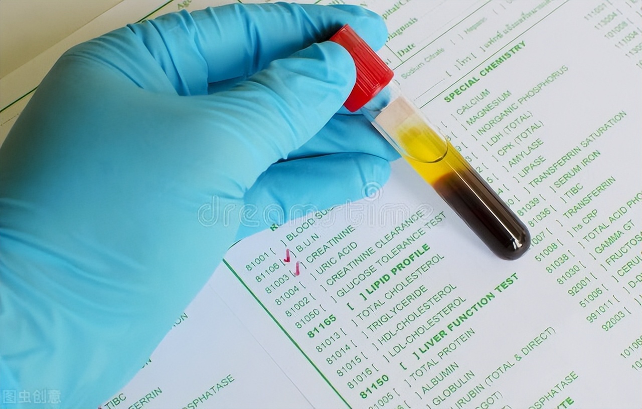 肌酐临界值如何降肌酐最有效,肌酐高怎么办降肌酐最佳方法