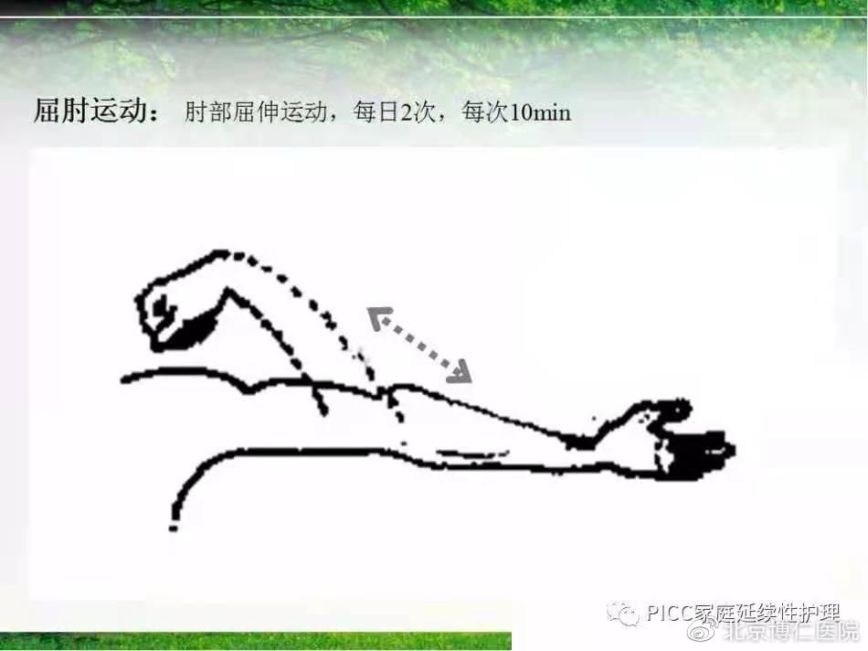 不扎肉肉、不咋疼、方便又实惠的“输液通道”,究竟是何方神圣?