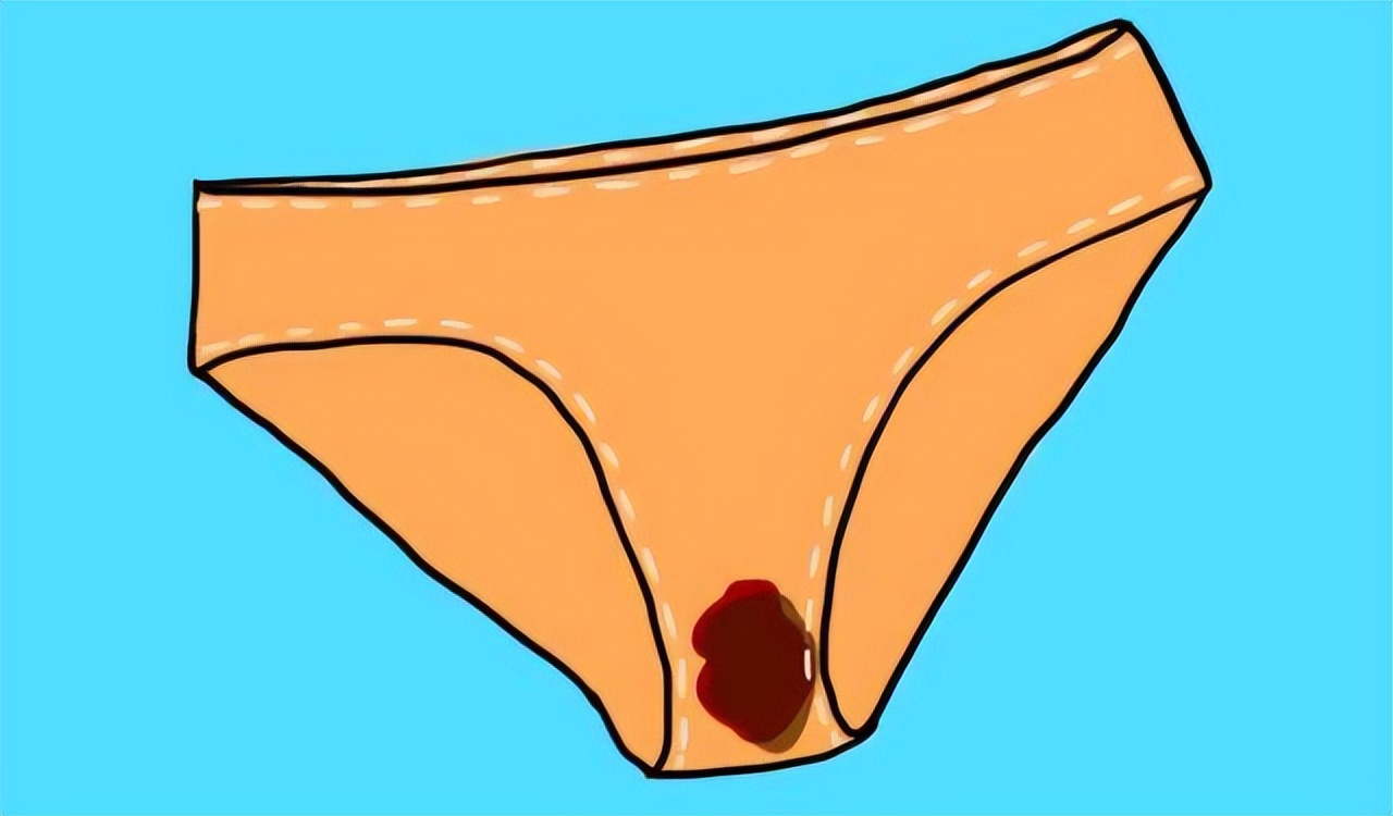 内裤分泌物有点黄黑怎么回事,为什么女生裤子有一股异味