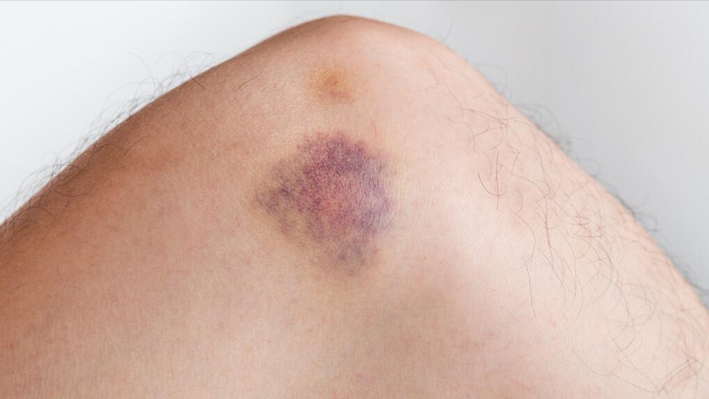 阿司匹林和阿托伐他汀吃多久停药,阿司匹林阿托伐他汀要终身服用吗