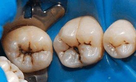 小洞不补大洞吃苦的意思,小洞不补大洞吃苦的道理