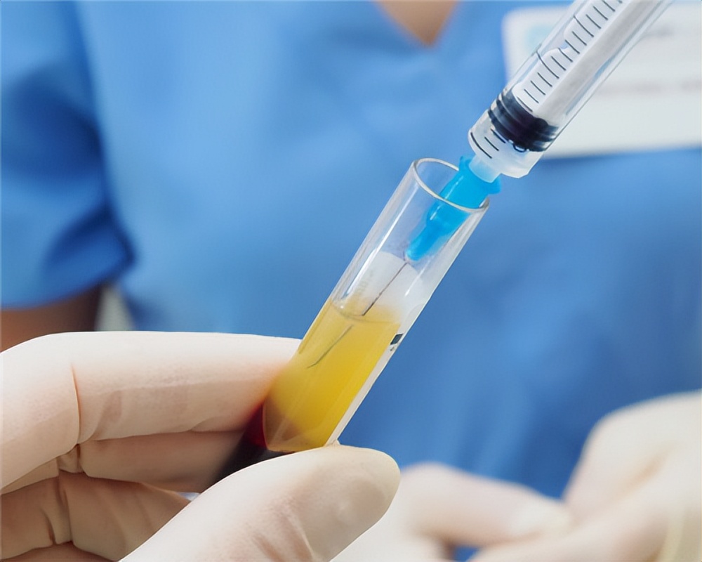 富血小板血浆因子作用,富血小板血浆治疗的目的和意义