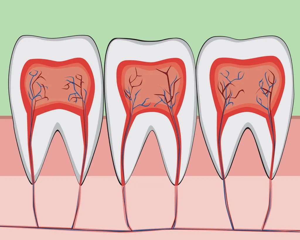 杀死牙神经后牙齿还能活多久,杀死牙神经牙能维持多久