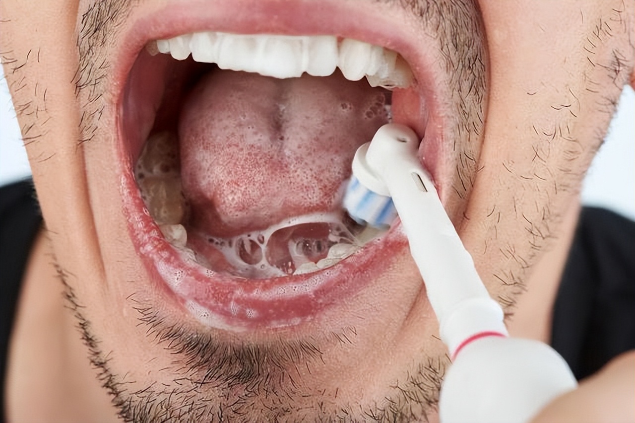 每天刷牙可以改善口臭吗,天天早晚刷牙口臭原因和治疗方法