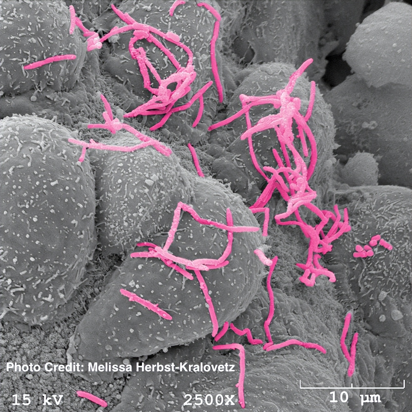 阴道菌群为什么会混乱,阴道菌群怎么分类