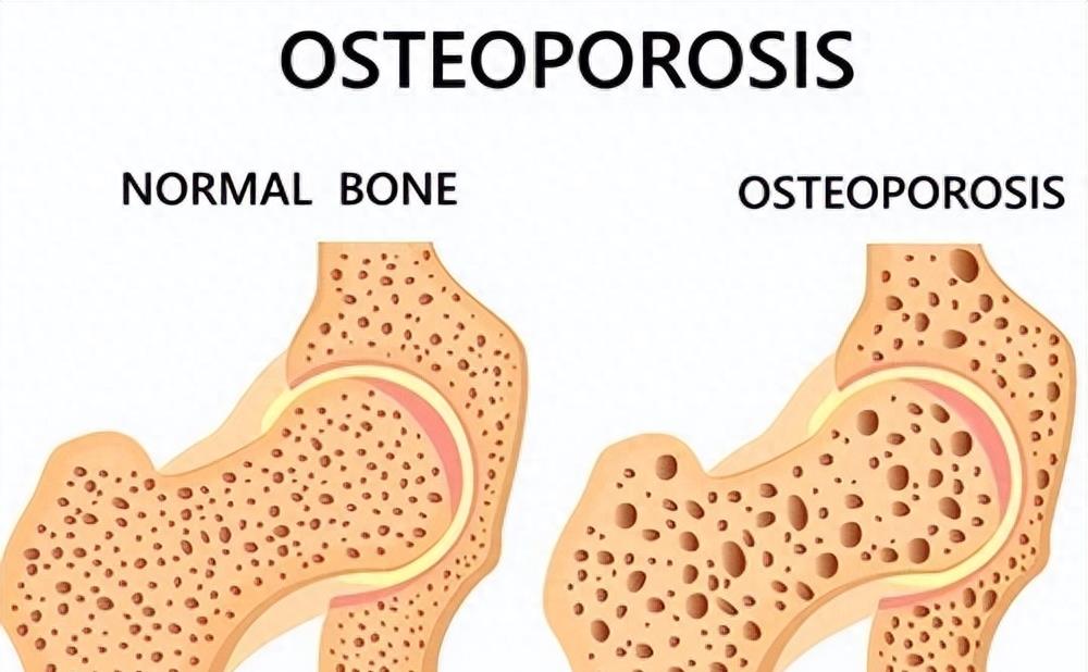 女性雌激素缺少身体出现什么症状,哪些现象说明雌激素低