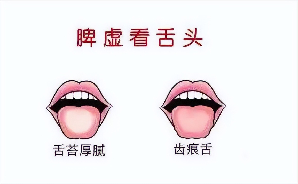 脾胃严重虚寒气血不足怎么调理,脾胃虚不吸收营养怎么办